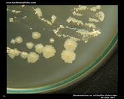 mueller hinton agar mycobacterium(rapidly growing)